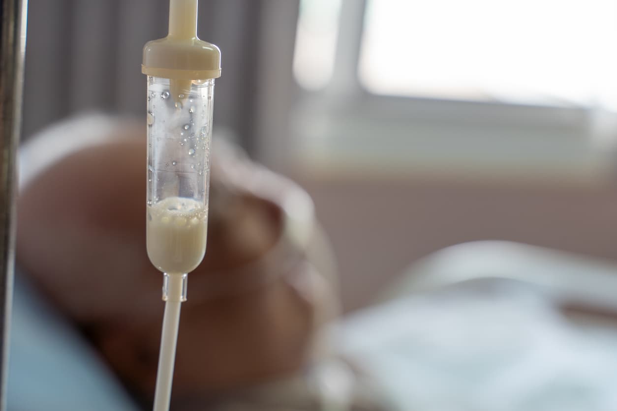 Nutrición Enteral y Parenteral